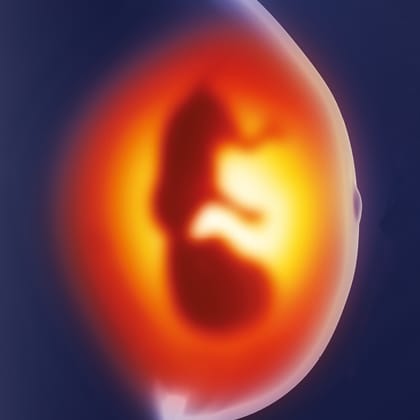 prenatal-screening-webinar-2020