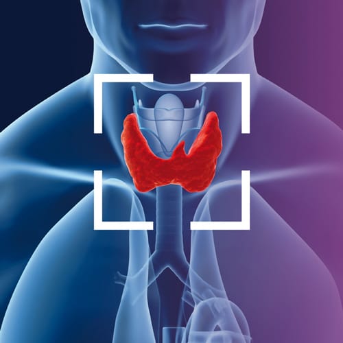 thyroid-diseases-biomarkers